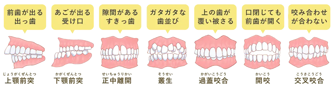 矯正歯科
