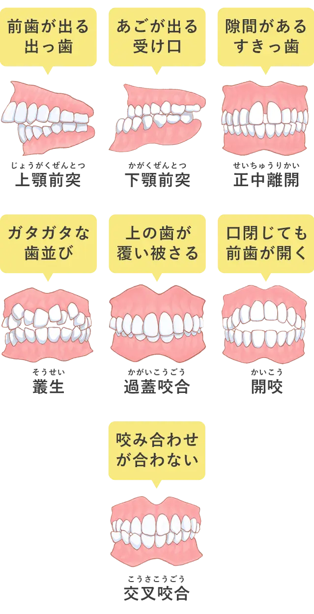 GPのための床矯正・矯正のすすめ 矯正歯科は八尾市の歯科（歯医者）こうたろう歯科・矯正歯科へ