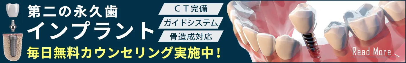 インプラント