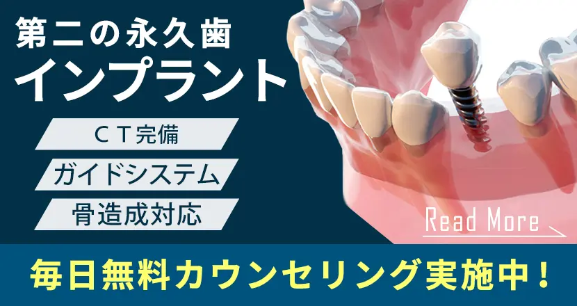 インプラント