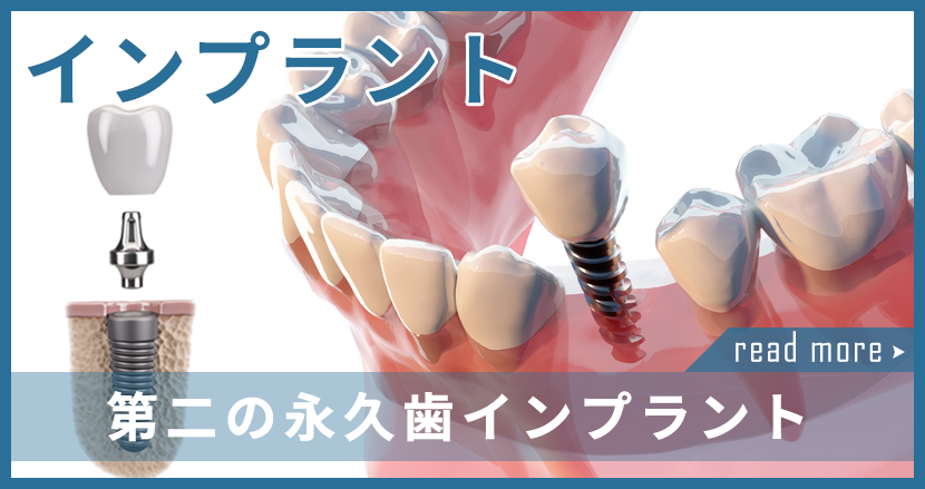 インプラント