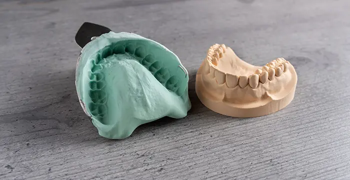 歯型採集