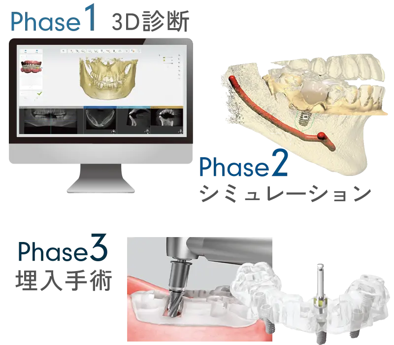 オステムワンガイド