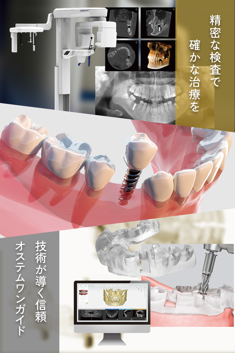 CT・ガイドシステム完備