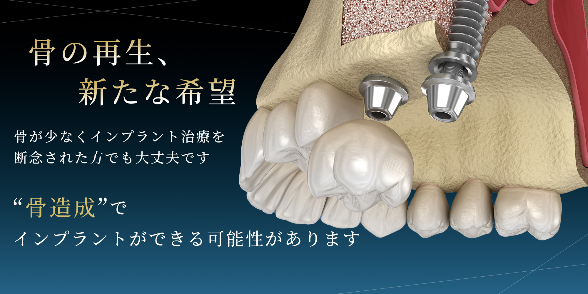 八尾市 骨造成対応