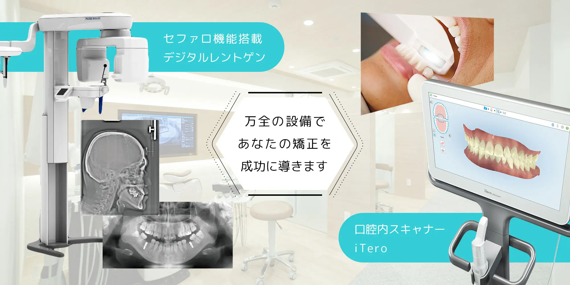 八尾市で口腔内スキャナー「iTero」導入