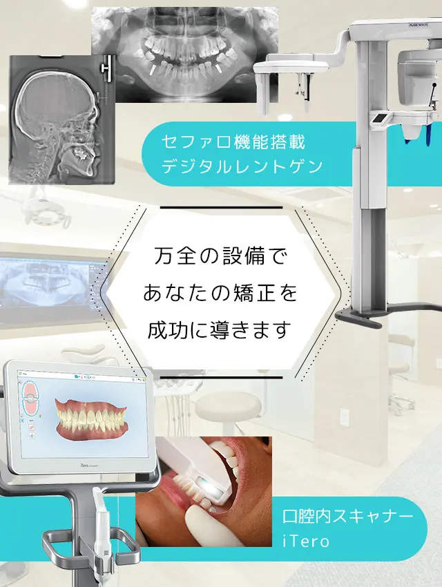 八尾市で口腔内スキャナー「iTero」導入